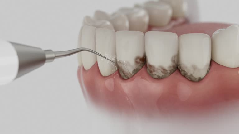 Trusted Emergency Dentist service in Mission Viejo, CA - Dentist Open Now